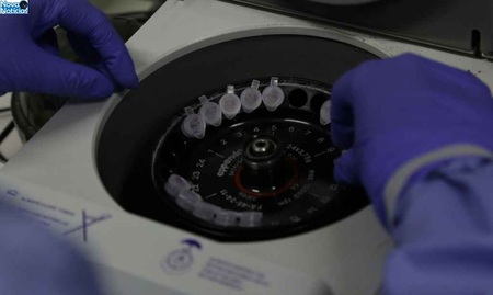 Left or right diagnostico laboratorial de casos suspeitos do novo coronavirus 2801209408