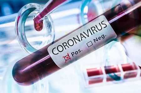 Left or right coronavirus positivo 1